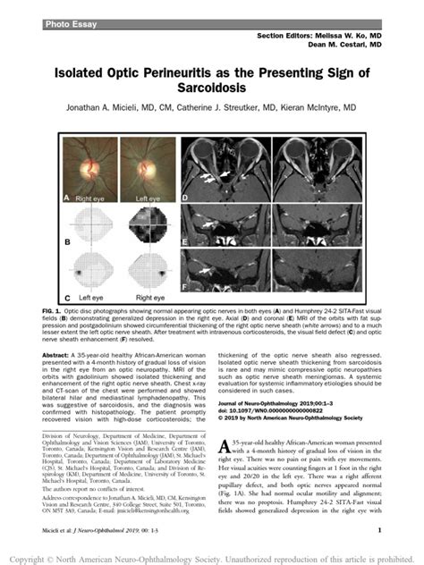 Isolated Optic Perineuritis As The Presenting Sign of Sarcoidosis | PDF ...