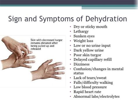 Pin by Ana Quiroz on senales de deshidratacion | Dehydration symptoms ...