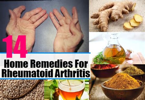 Rheumatoid Arthritis - Home Remedies And Natural Cures