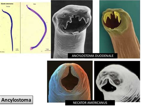 Hookworm infection, symptoms, diagnosis & hookworm treatment in humans