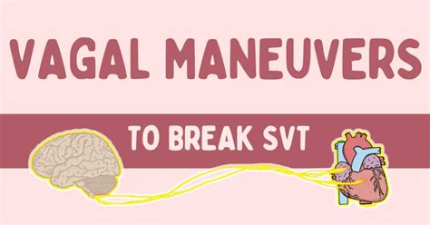 Vagal Maneuvers: How to Stop your Patient’s SVT | Health And Willness