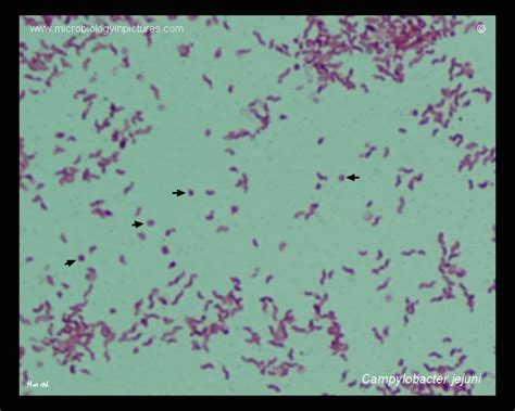 Campylobacter jejuni under microscope. Campylobacter jejuni Gram-stain ...