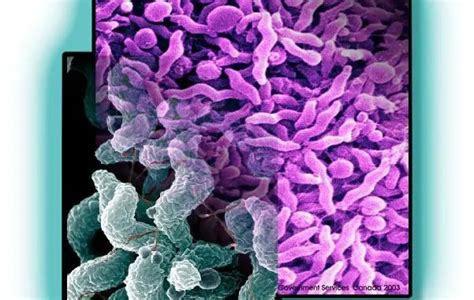 Campylobacter Jejuni: Disease, Properties and Laboratory diagnosis ...