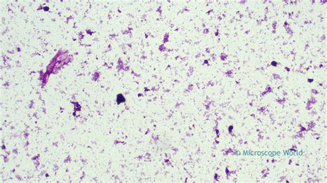 Microscope World Blog: Diphtheria under the Microscope