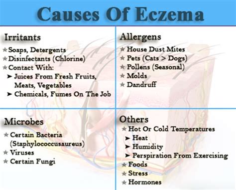 All about Symptoms and Causes of Eczema | Eczema, Eczema causes, What ...