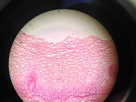 Non Keratinized Stratified Squamous Epithelium (Medium) | Flickr