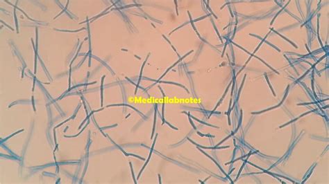 Trichosporon: Introduction, Morphology, Pathogenicity, Lab Diag