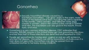 Chlamydia and gonorrhea symptoms male - japanright