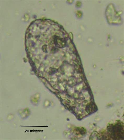 Difflugia (Bacteria and "Protists" of Travis County, TX; USA) · iNaturalist