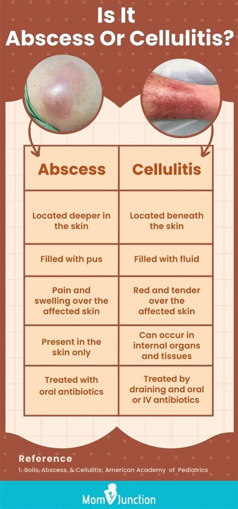 Skin Abscess In Children: Causes, Home Treatment And Care