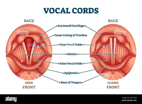 Vocal cords labeled anatomical and medical structure and location ...