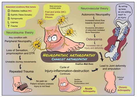 Neuropathic arthropathy: Charcot arthropathy - Creative Med Doses