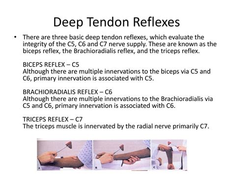 Brachioradialis Reflex