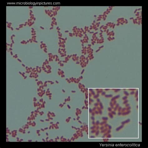 Yersinia enterocolitica. Gram stain and cell morphology. Yersinia ...