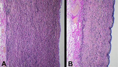 Histology of the aorta demonstrating a section of... | Download ...