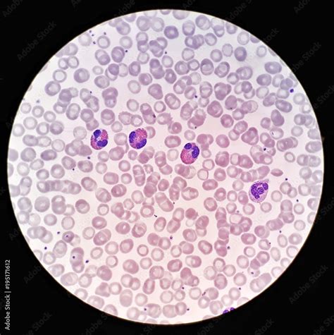 Human Blood Cell Under Microscope