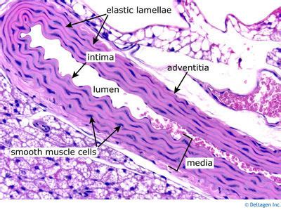 Vessels Histology - Aorta (labels) - histology slide