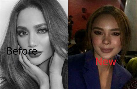 Netizens Notice the New Nose of Arci Munoz | Attracttour