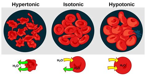 Tonicity - Wikipedia