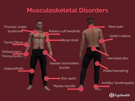 Musculoskeletal Disorders in the Workplace and Prevention.