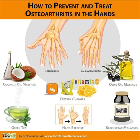 What Is the Best Treatment for Osteoarthritis of the Hands ...