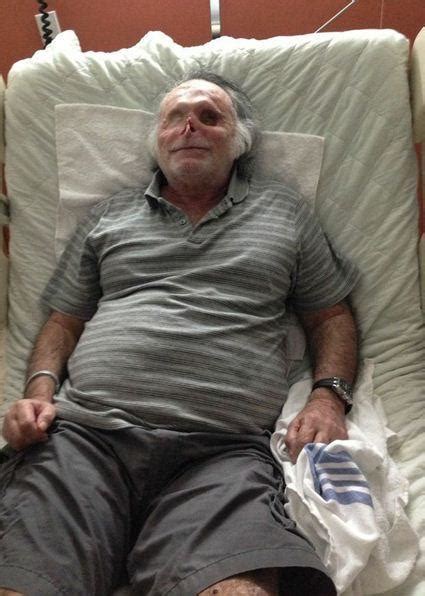 Ronald Poppo: 'Causeway Cannibal' victim keeps positive attitude nearly ...