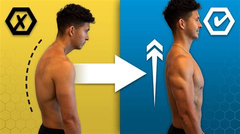 how to fix rounded back, How Fix Rounded Shoulders (Best - Posture ...