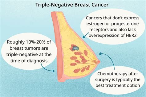 Triple Negative Breast Cancer 5-Year Survival Rate