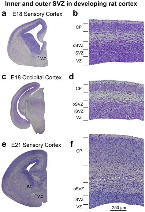 Inner and outer SVZ in the developing rat cortex. (a, c, e ...