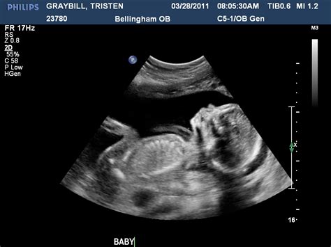 30 Week Ultrasound Boy