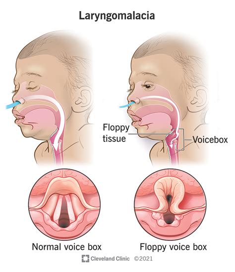 エフェクター Voice Box