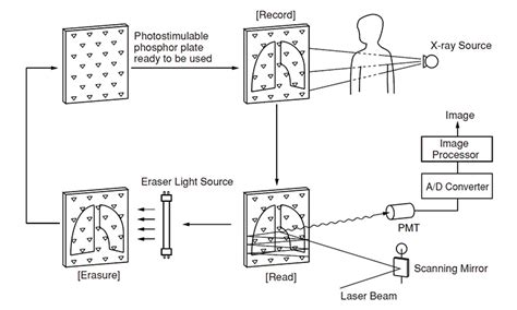 Intraoral computed radiography (CR)