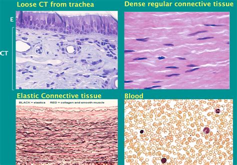 Connective Tissue Labeled