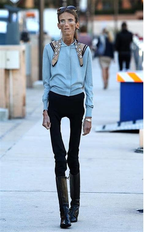 9 skinniest people in the world - Tuko.co.ke