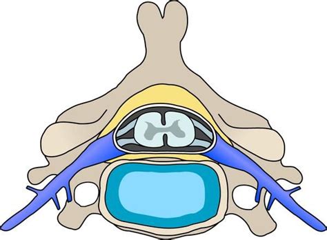 Possible causes for bilateral ankle clonus if spine and brain MRI are ...