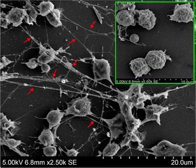 Frontiers | Neutrophil Extracellular Traps of Cynoglossus semilaevis ...