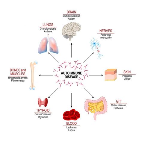 What are Corticosteroids - Facty Health