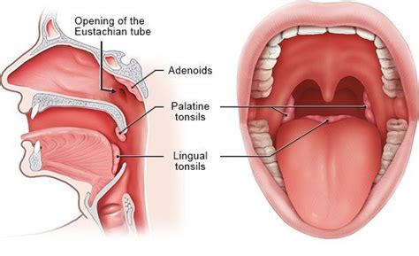 How do the tonsils work? | informedhealth.org