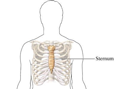 Sternum (Breastbone) Pain - Causes, Diagnosis and Treatments