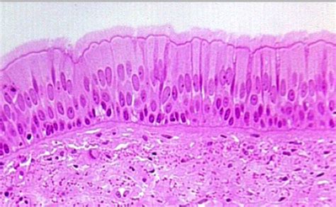 PSEUDOSTRATIFIED COLUMNAR EPITHELIUM | Microanatomy Web Atlas | Gwen V ...