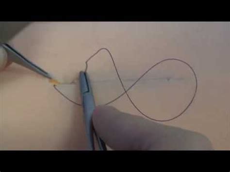 Subcuticular Suture - YouTube