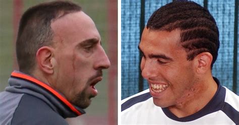 How Did Franck Ribéry And Carlos Tevez Get Their Permanent Scars? - I'm ...