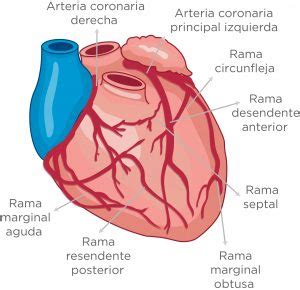 Tranvía Violeta Catedral tronco coronario izquierdo anatomia Revelar ...