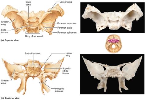 Orbital Surface Of Sphenoid