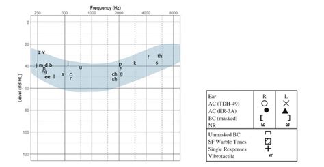 What is an Audiogram? – Understanding Hearing Test Results ...