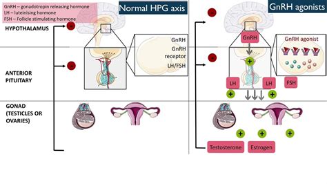 Gonadotropin-releasing hormone (GnRH) agonists - YouTube