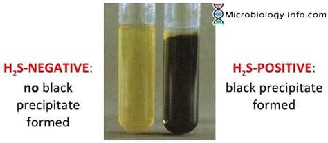 Hydrogen Sulfide Test - Principle, Procedure, Uses and Interpretation