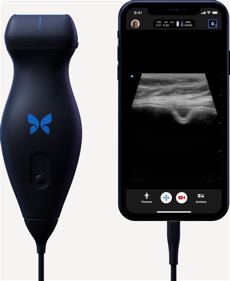 Butterfly iQ+ Ultrasound System | Sientra