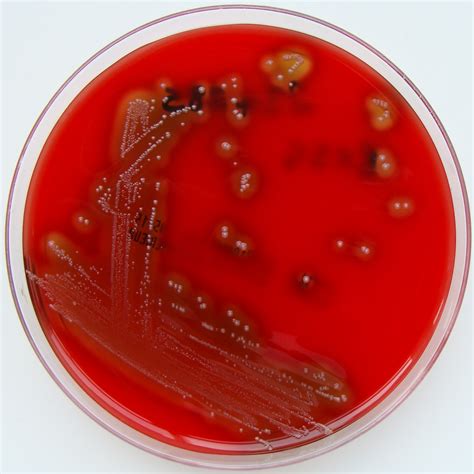 Streptococcus Pyogenes Throat