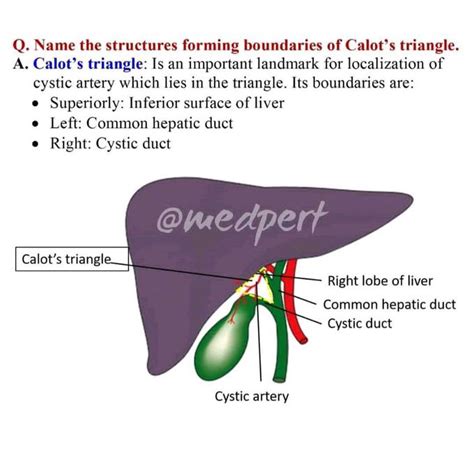 #Calot's triangle - MEDizzy